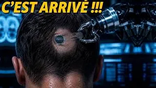 Miniature : Pour la première fois, Neuralink laisse une IA implanter une puce chez un humain