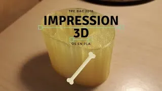 Miniature : Impression 3D d'un os - (Projet TPE 2017-2018)