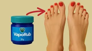 Miniature : 47 Astuces Géniales avec le Vicks VapoRub à Connaître Absolument ! - Soins & Usages Insolites