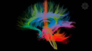 Miniature : Neurinfo : à Rennes, une nouvelle IRM ultra-performante dédiée à la recherche et au soin