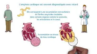 Miniature : Léon et la maladie caméléon : Quand atteintes rhumato et surdité cachent une amylose cardiaque