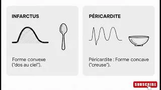 Miniature : ECG : Ne ratez JAMAIS un Infarctus (ST+ & Miroirs)