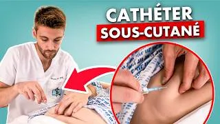 Miniature : Perfusion sous cutanée : maîtriser la pose sans erreur - soin infirmier