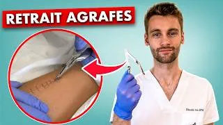 Miniature : Ablation d'agrafes chirurgicales sans erreur - soin infirmier
