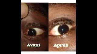 Miniature : Guéridon Instantanée: L'OEIL de son Enfant Rétabli Après l'Action Prophétique  #prière #miracle#foi