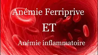 Miniature : Anémies Ferriprive et inflammatoire ( Diagnostic biologique, Étiologies et Physio-Pathology)