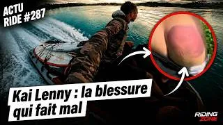 Miniature : Blessure de Kai Lenny ! Un grimpeur tombe dans un volcan ! FMX à la Maison Blanche !