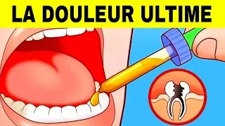 Miniature : 10 astuces pour soulager une rage de dent en 60 secondes