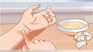 Miniature : Voici comment ma grand-mère utilise de l’ail pour soigner les maux de dents, les infections d’ore...