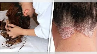 Miniature : 7 Maladies provoquées par le fait de dormir avec des cheveux mouillés