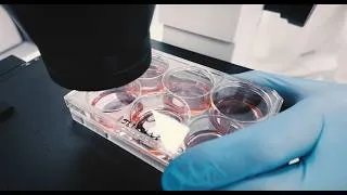 Miniature : Optimiser la production de protéines d'intérêt thérapeutique