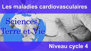 Miniature : Les maladies cardiovasculaires