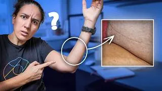 Miniature : Personne ne parle de cette ligne sur l’avant-bras (et c’est bizarre)