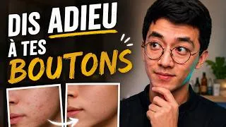 Miniature : Pourquoi mes boutons reviennent toujours au même endroit ?
