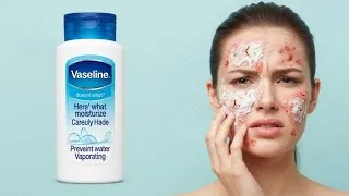 Miniature : On t’a menti sur la vaseline.