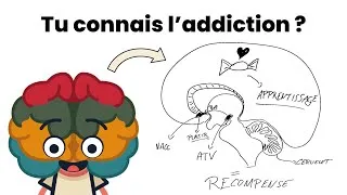 Miniature : Addiction