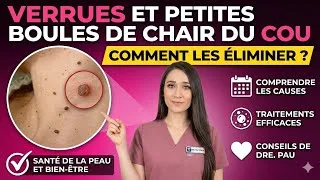 Miniature : Pâtie Comment ÉLIMINER les "verrues" et petites boules de chair sur le cou ?