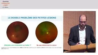 Miniature : Dernières nouvelles des essais en ophtalmologie