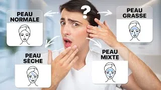 Miniature : Je t’aide à reconnaître ton type de peau ! (Pour adopter la bonne skincare routine)