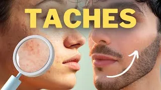 Miniature : COMMENT ENLEVER LES TACHES SUR LA PEAU ?
