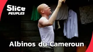Miniature : Cameroun : les albinos face au poids des croyances | DOC ENTIER | SLICE PEUPLES