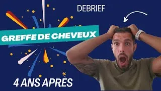 Miniature : Debrief greffe de cheveux 4 ans après ! #greffecheveux