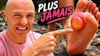 Miniature : Ampoules en trail, fait ça, c'est non négociable !