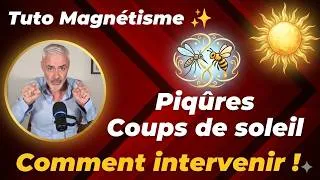 Miniature : Piqûres et coups de soleil, comment intervenir efficacement !
