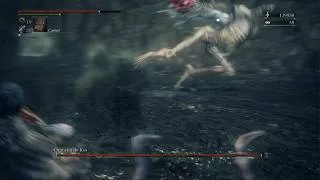 Miniature : Bloodborne - dlc - Boss Orphelin de Kos et parasite de Kos