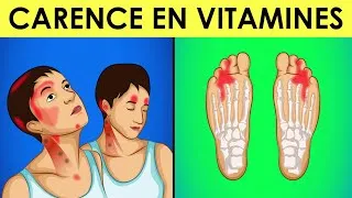 Miniature : Symptômes d'une CARENCE en Vitamine B12 : Ne les Ignorez Pas !