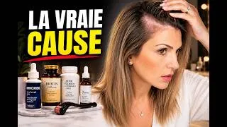 Miniature : +40 Carences et perte de cheveux : ce que les médecins ne disent pas toujours