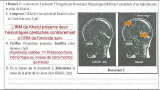 Miniature : 3AC - (Correction) Examen régional Marrakech - Safi 2025 SVT