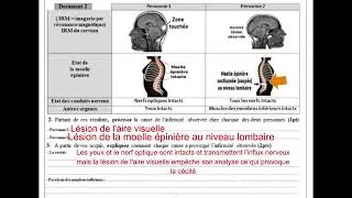 Miniature : 3AC - (Correction) Examen régional Casa-Settat 2025 SVT