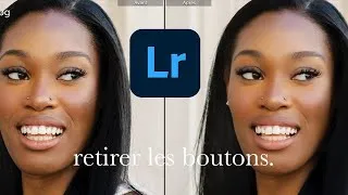 Miniature : RETOUCHES LIGHTROOM : Comment retirer des légères imperfections en 2MIN!