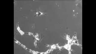 Miniature : Le cerveau lorsqu'il pense, apprend - les neurones s'allument et se connectent pour former un réseau