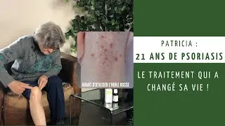 Miniature : Après 21 ans de maladie, Patricia trouve un traitement naturel pour traiter son psoriasis !