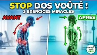 Miniature : Dos voûté : comment corriger sa posture rapidement