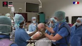 Miniature : [Ideas] More precise neurosurgery thanks to AI