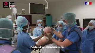 Miniature : [Ideas] RebrAin : une neurochirurgie plus précise grâce à l'IA