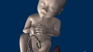 Miniature : Le fétus présentation