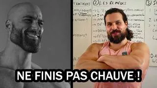 Miniature : 1245. MASTERCLASS CALVITIE : tu ne veux pas finir chauve ? Regarde cette vidéo !