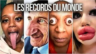 Miniature : 15 PERSONNES AVEC LES PARTIES DU CORPS LES PLUS GRANDES DU MONDE