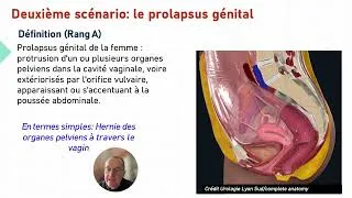 Miniature : Item 44.1 Prolapsus génitaux Anatomie et épidémiologie en 15 mn