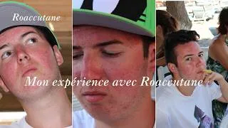 Miniature : Acné sévère → peau nette ? Mon parcours avec Roaccutane
