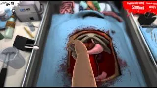 Miniature : Surgeon Simulator 2013-double-greffe de reins-Réussi