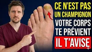 Miniature : Ongles jaunes et épais ? Votre corps essaie peut-être de vous alerter