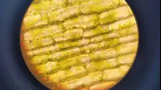 Miniature : Cellules d'élodée observées au microscope optique