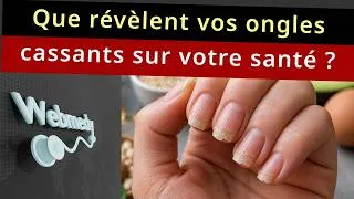 Miniature : Comment réparer les ongles cassants