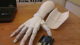 Miniature : Une Main Bionique programmée par des STI2D