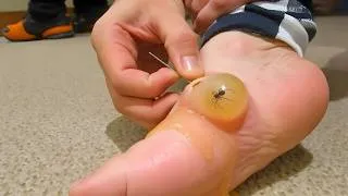 Miniature : je n'aurais pas dû le retirer... 😭